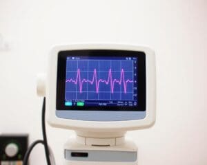 Deutschland: Wann brauche ich ein EKG?